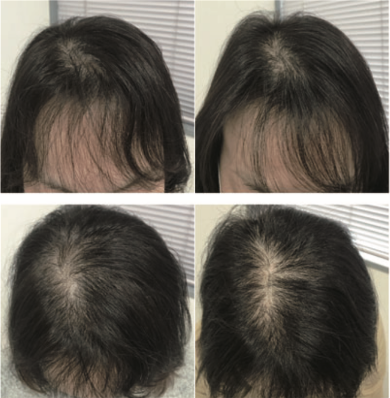 在家洗頭就能養出張員瑛、Karina的女團水光髮？像臉部肌膚一樣對待頭皮，不用花錢做護髮療程就能擁有超心動女團髮質♡