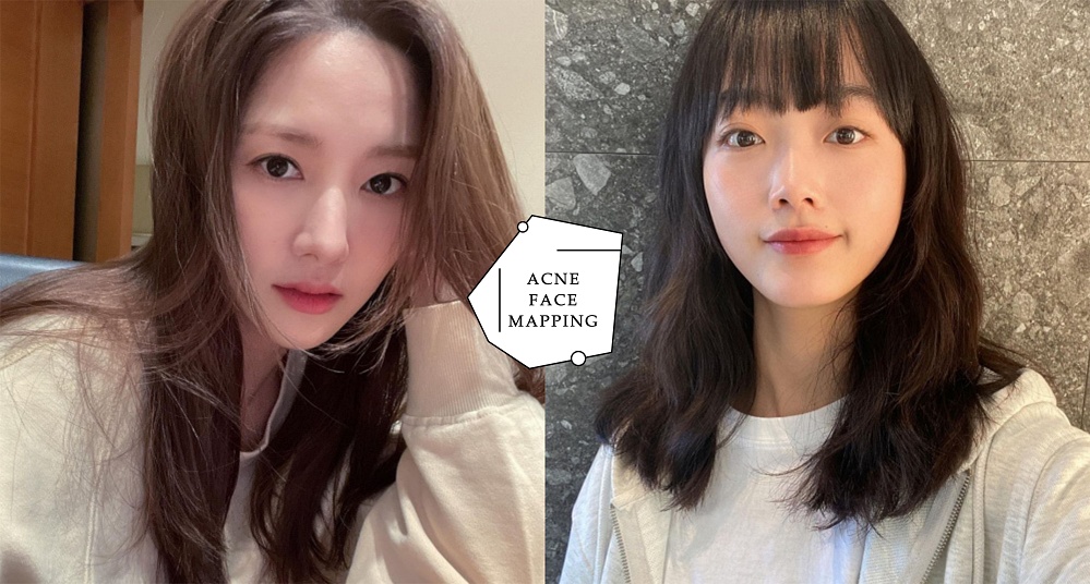 痘痘肌必看！找出根本來抗痘！從痘痘的生長位置，揪出身體的隱藏問題！